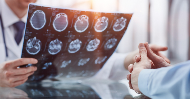 brain injury scan